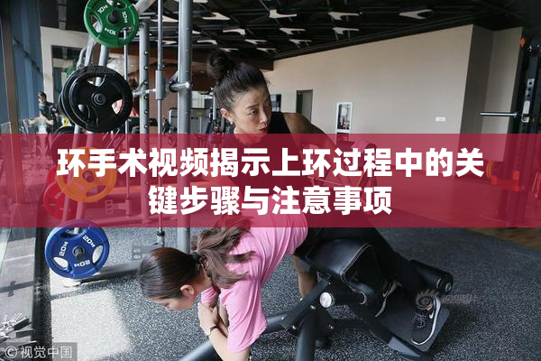 环手术视频揭示上环过程中的关键步骤与注意事项