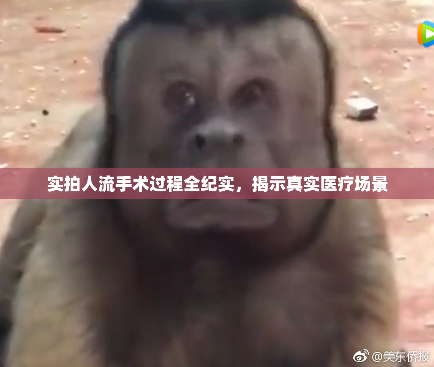 实拍人流手术过程全纪实，揭示真实医疗场景