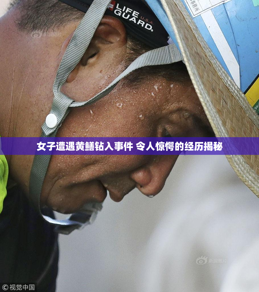 女子遭遇黄鳝钻入事件 令人惊愕的经历揭秘
