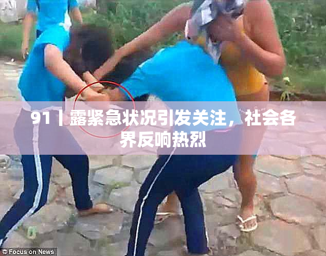 91丨露紧急状况引发关注，社会各界反响热烈