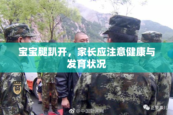 宝宝腿趴开，家长应注意健康与发育状况