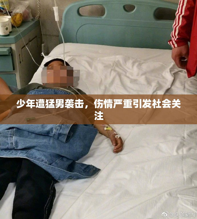 少年遭猛男袭击，伤情严重引发社会关注