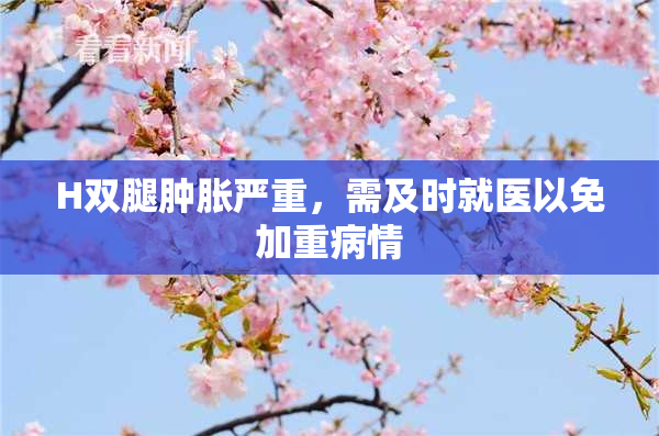 H双腿肿胀严重，需及时就医以免加重病情