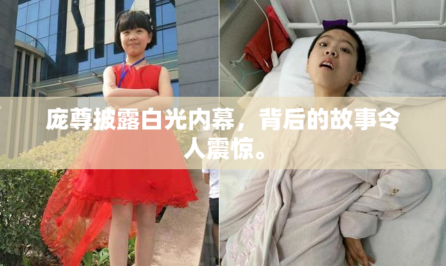 庞尊披露白光内幕，背后的故事令人震惊。