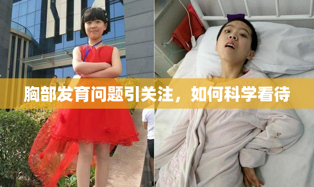 胸部发育问题引关注，如何科学看待