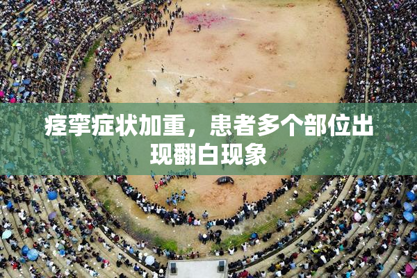 痉挛症状加重，患者多个部位出现翻白现象